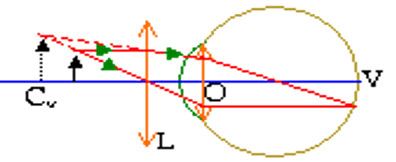 vien thi 2.jpg